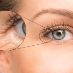 Odkiaľ pochádzajú prvé vrásky? 8 potravín, ktoré urýchľujú starnutie